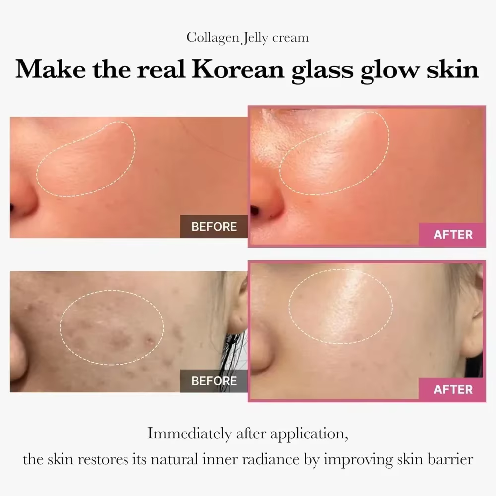 Crème de gelée collegène 100ML, hydrate en profondeur, ferme, brillante, réduit l'affaissement et les rides, augmente la peau, soins coréens pour la peau, masque facial