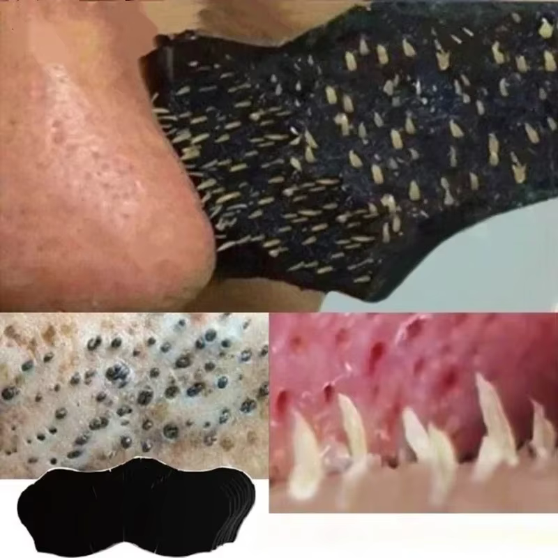 Masque unisexe pour éliminer les points noirs