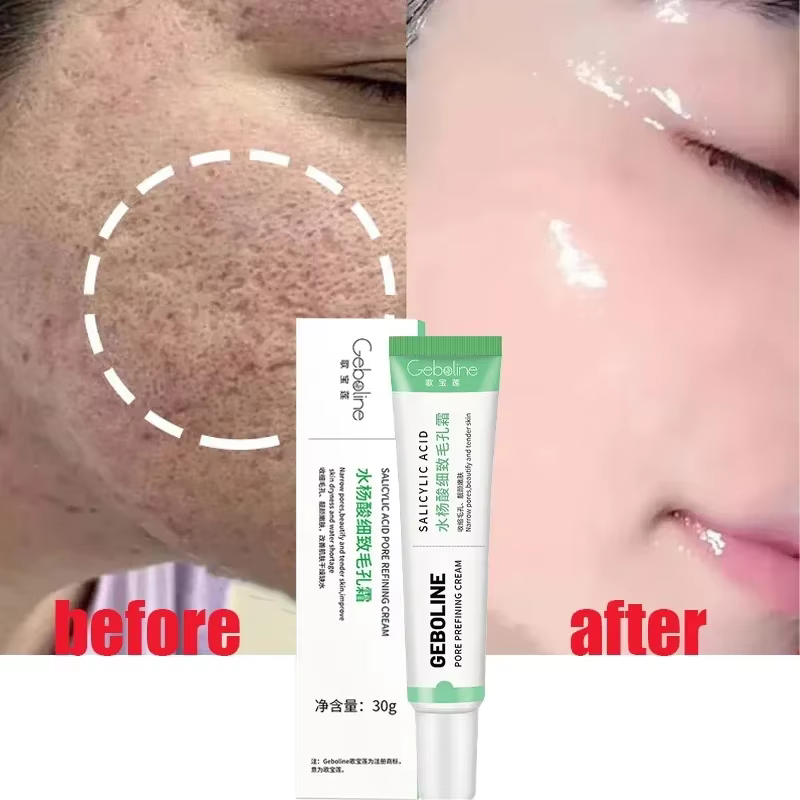 Crème de rétrécissement des pores à l'acide salicVAC, élimination rapide des grands pores, élimine les points noirs, resserre le visage, lisse la peau, produit de soin coréen