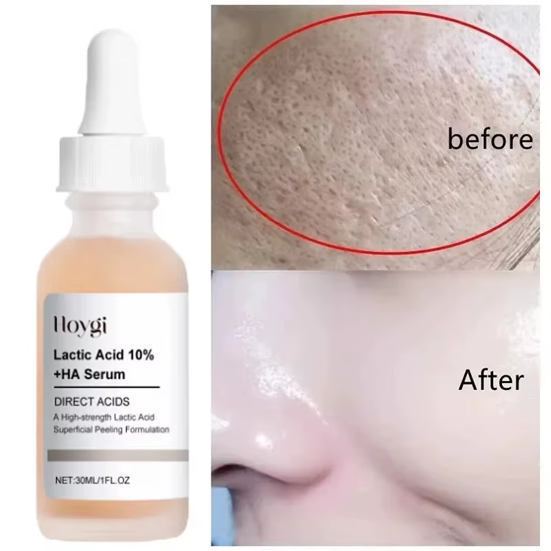 Acide lactique rétrécit les Pores sérum rapide grands
