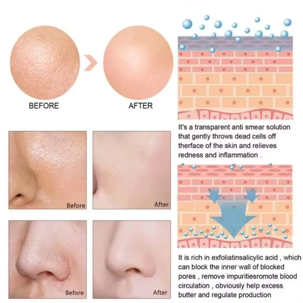 Sérum d'élimination des grands Pores