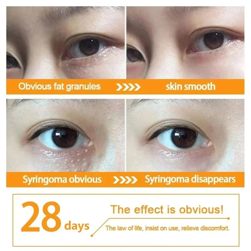 Crème pour les yeux dissolvant de granulés de graisse