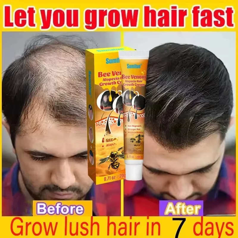 Crème de croissance des cheveux, Capsule essentielle pour une repousse rapide en 7 jours, Anti-chute de cheveux, réparation de la calvitie, traitement du cuir chevelu endommagé, pour femmes et hommes