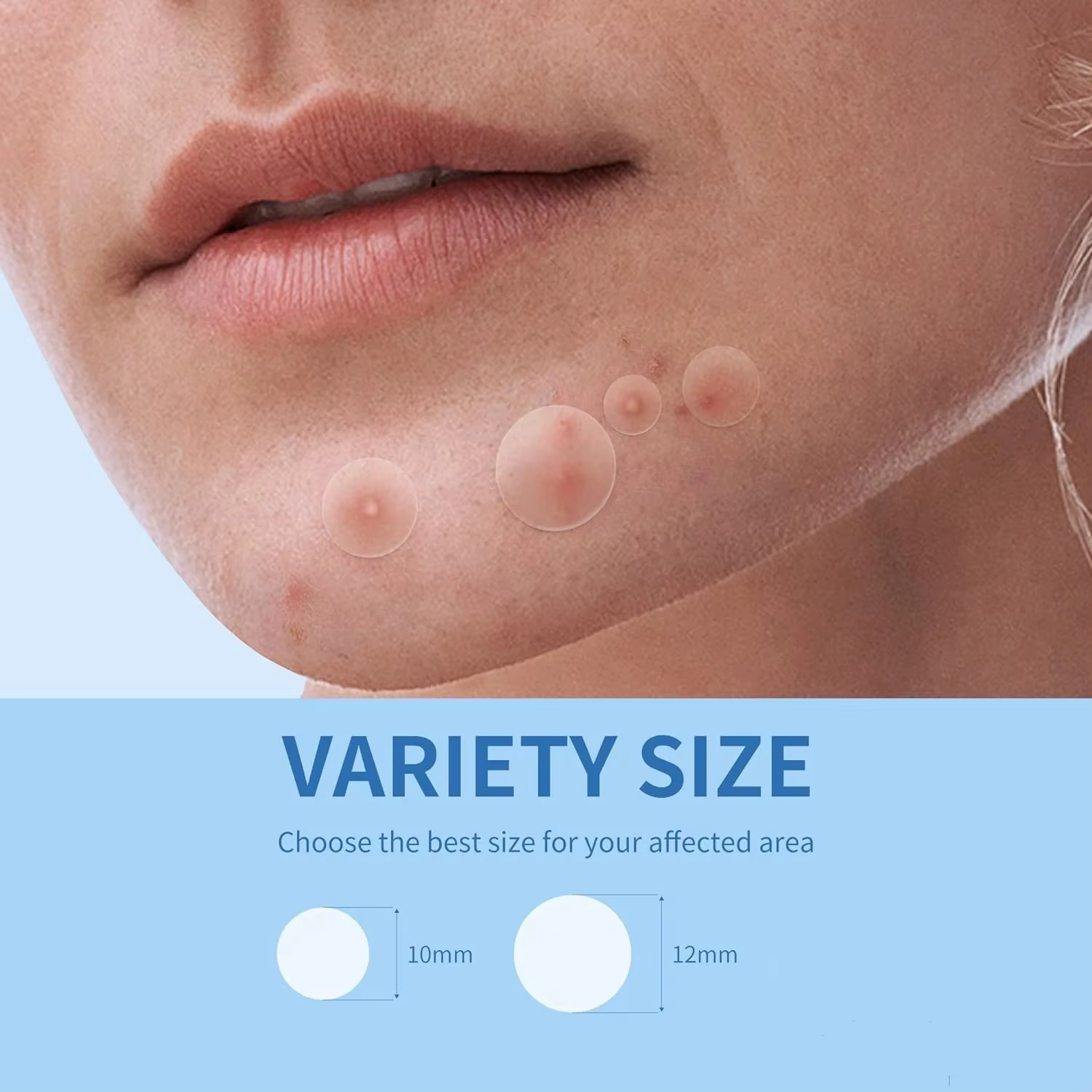 360 pièces visage acné Patch Invisible soins de la peau bouton