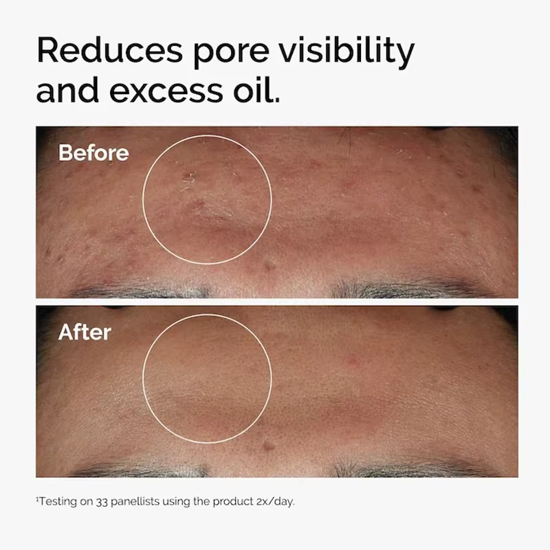 Sérum Niacinamide 10% + Zinc 1% 30ml
