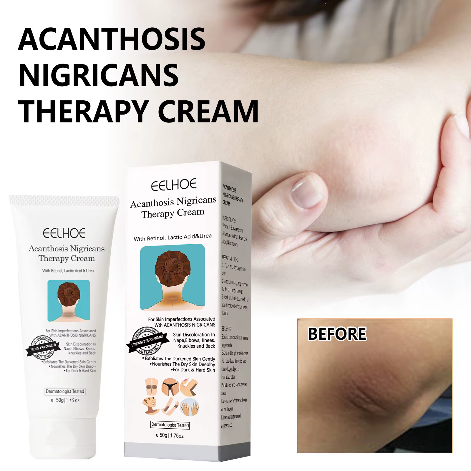 Crème blanchissante éclaircissante pour la peau foncée