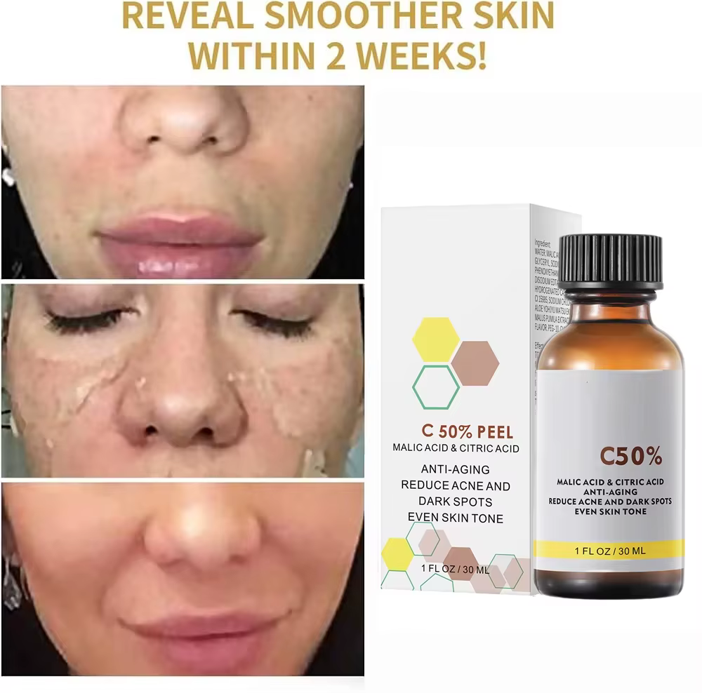 Mélanine de soins du visage pour une peau plus éclatante