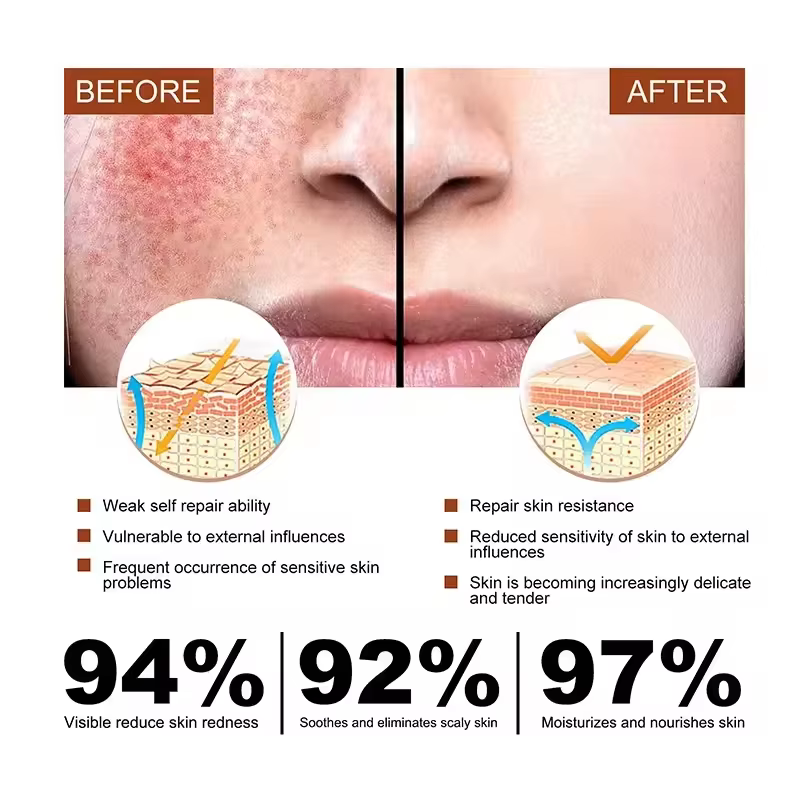 Crème réparatrice des rougeurs du visage coréenne