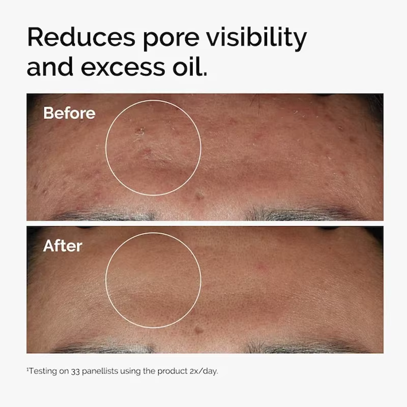 Niacinamide 10% + Zinc 1% sérum 30ml améliore la luminosité de la peau renforcer la barrière contre l'humidité