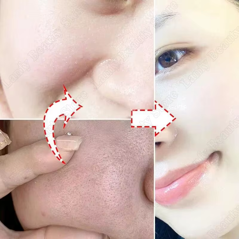 Crème Nettoyante pour les Pores à l'Acide Salicylique