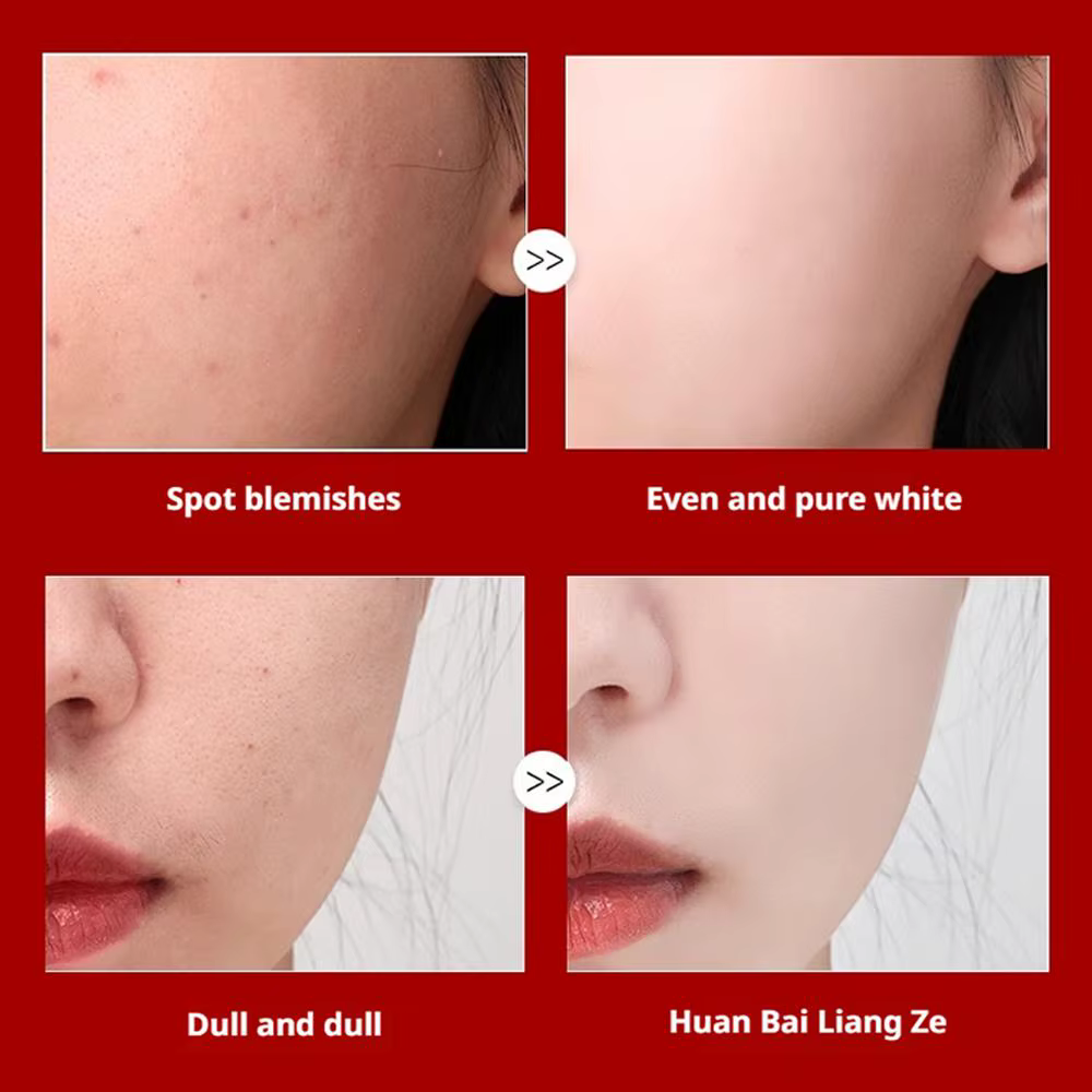 Crème blanchissante anti-taches, éclaircissante pour la peau, élimine rapidement la Pigmentation de la mélanine, mélasma, taches foncées, soins pour la peau