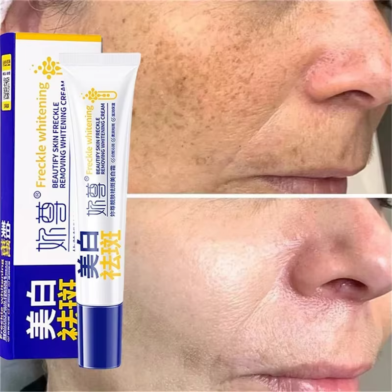 Crème blanchissante puissante anti-taches