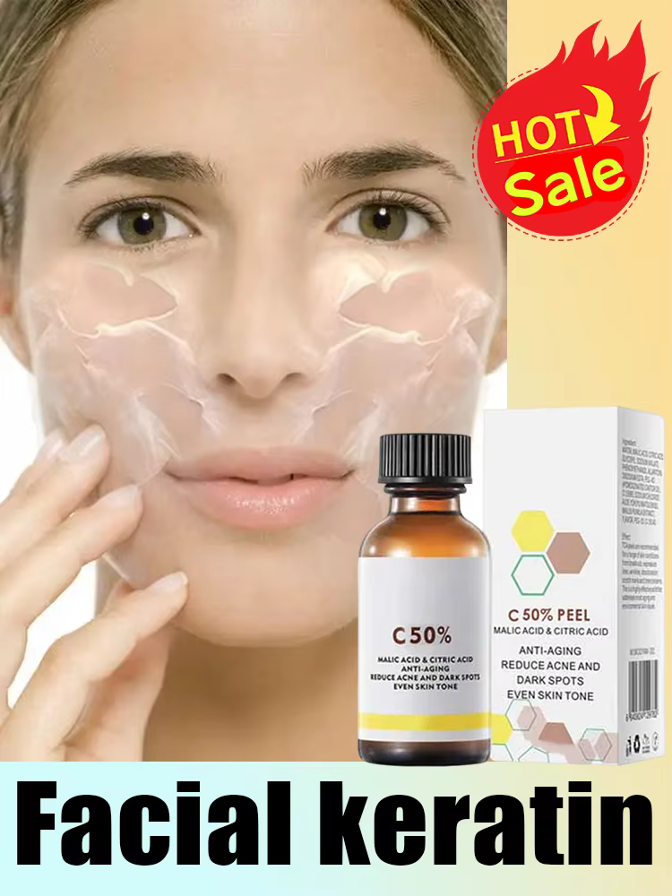 Sérum de Peeling à l'acide