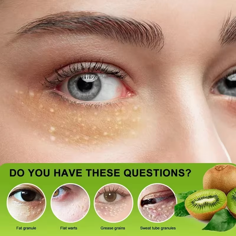 Dissolvant de granulés de graisse crème pour les yeux efficace élimine