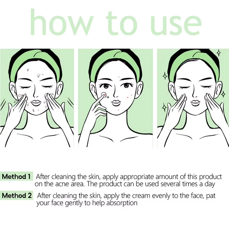 Crème Visage Anti-Acné à Base de Plantes
