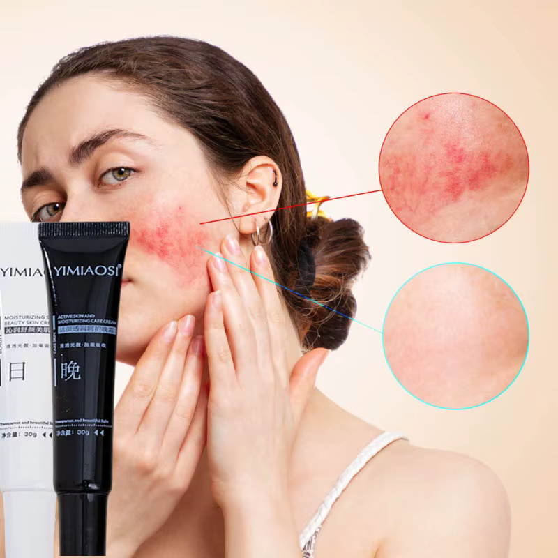 Crème Réparatrice Anti-Rougeurs Visage – Améliore la Peau Sensible et la Sécheresse – Lotion Hydratante Apaisante – Élimine la Rosacée – Jour et Nuit – Cosmétiques Coréens
