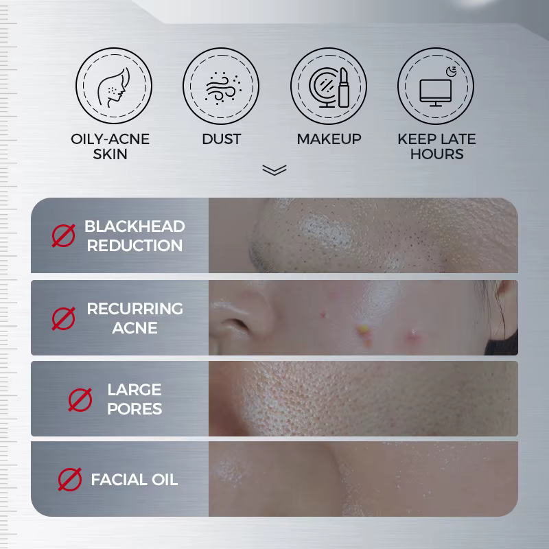 NING DERMOLOGIE Nettoyant pour le visage coréen aux acides aminés avec acide salicylique aide à resserrer les pores