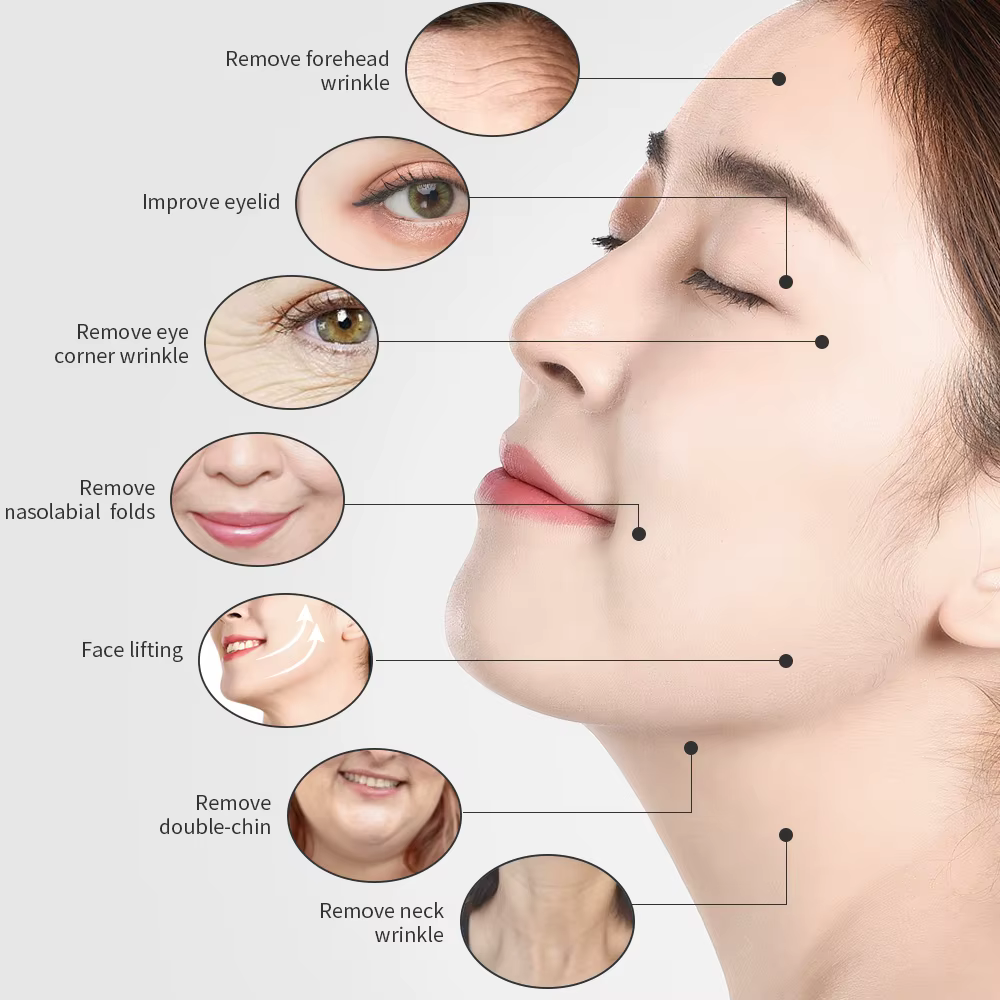 Beauty Star – Machine faciale tripolaire 3 en 1