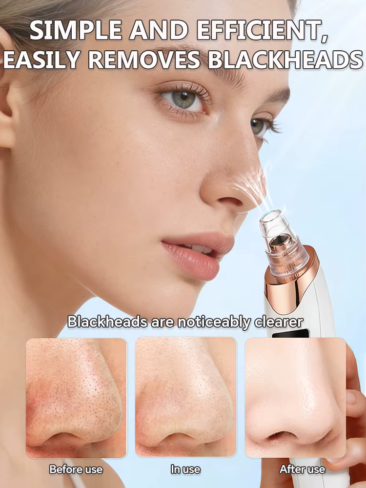 Masque anti-points noirs et anti-imperfections - Aspirateur de pores - Éliminateur de points