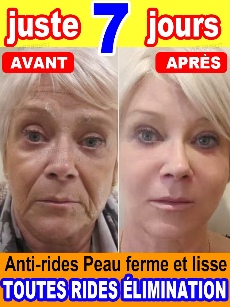 Pas de rides, 20 ans plus jeune