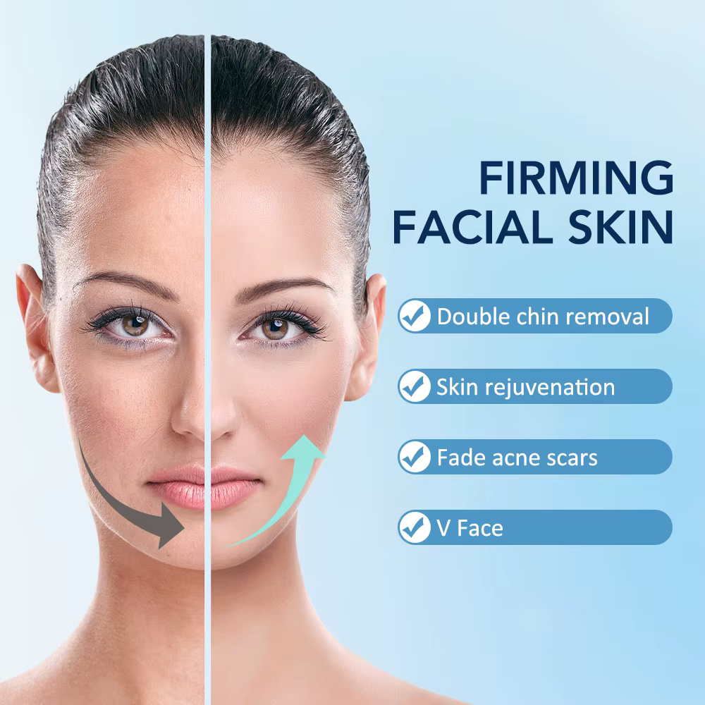 Dispositif électrique de Lifting du visage