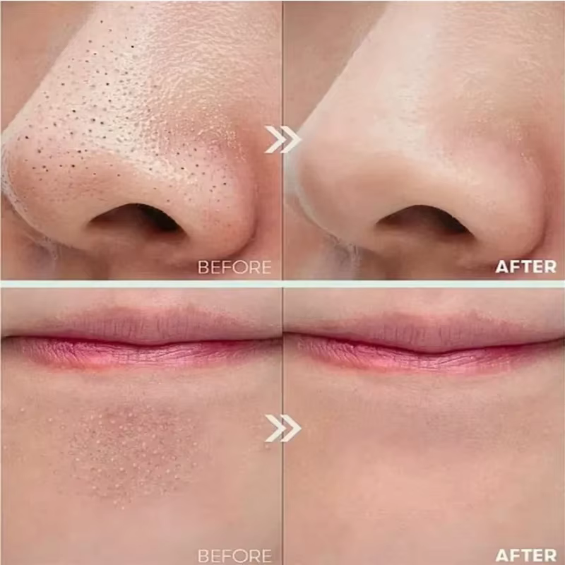 Sérum Exfoliant au Riz Blanc et Noir – Peeling Visage Hydratant