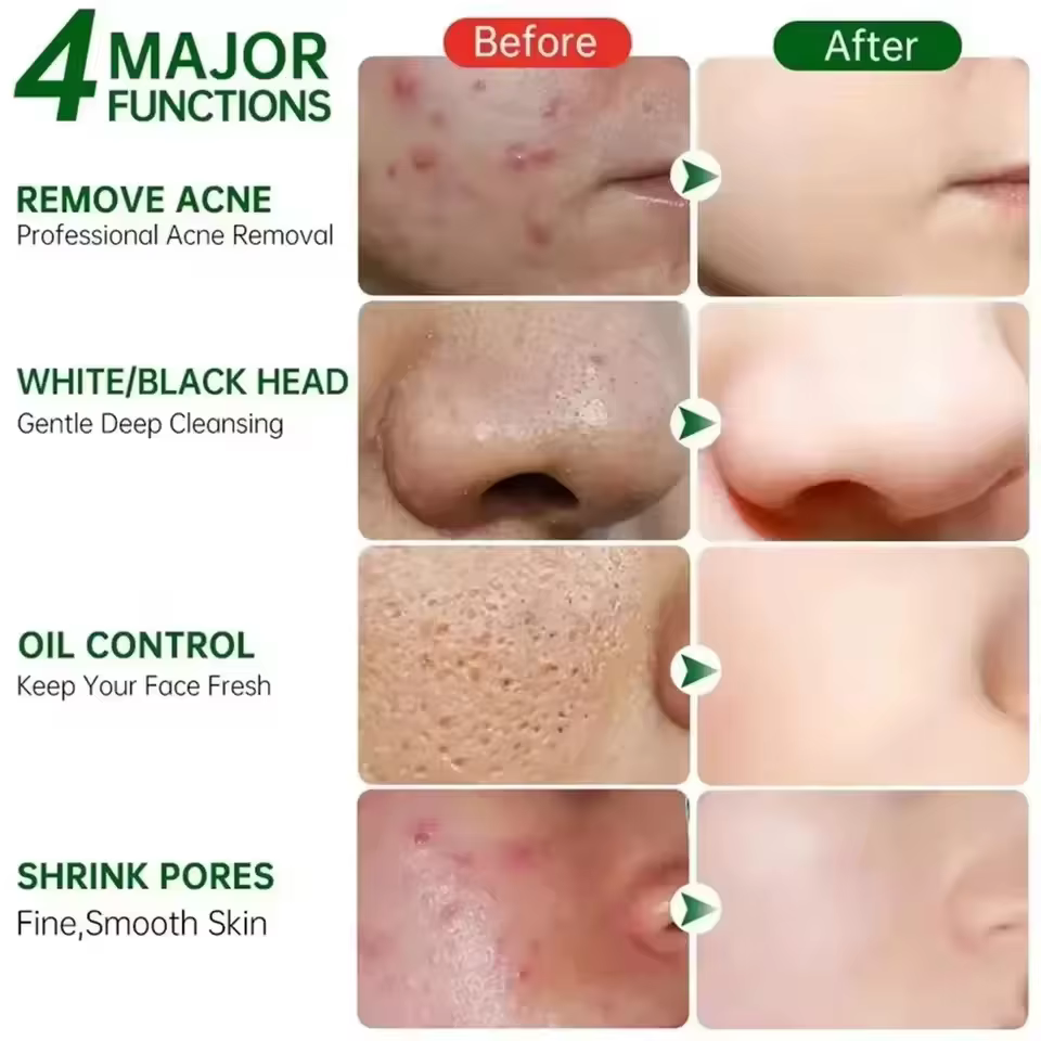 Crème Nettoyante pour les Pores à l'Acide Salicylique