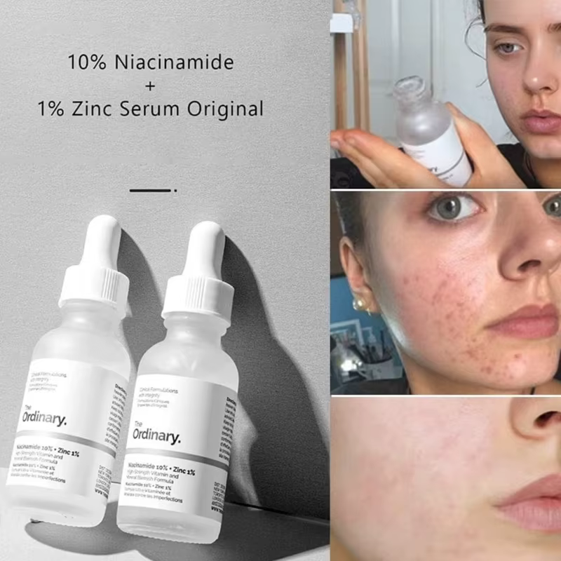Sérum The Ordinary Niacinamide 10% + Zinc 1% 30ml