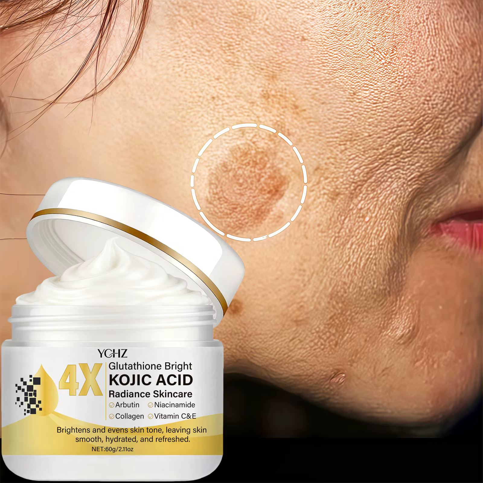 Crème à l'acide kojique