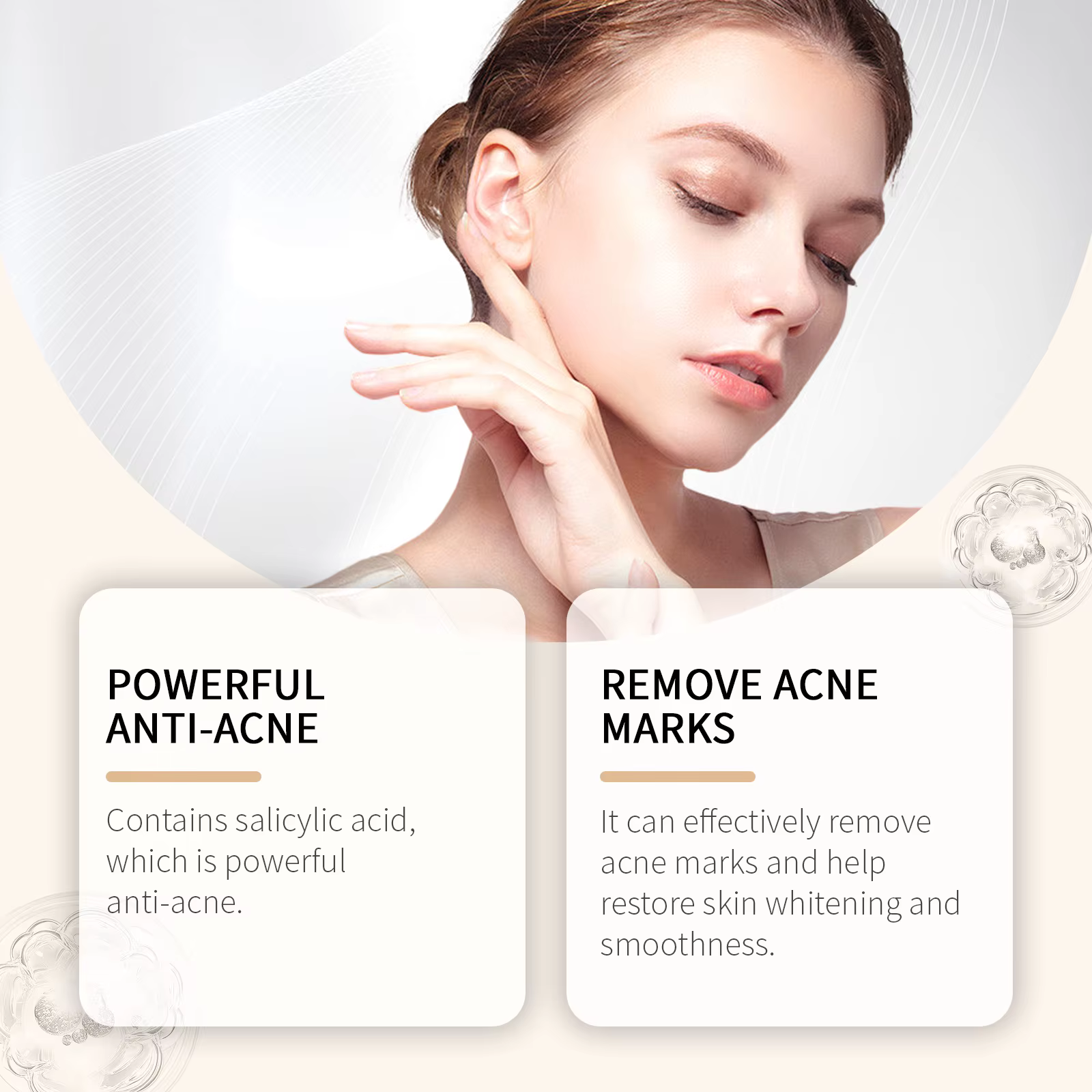 Calendula crème à l'acné Anti-acné et marques de décoloration contrôle du sébum rétrécissement des Pores