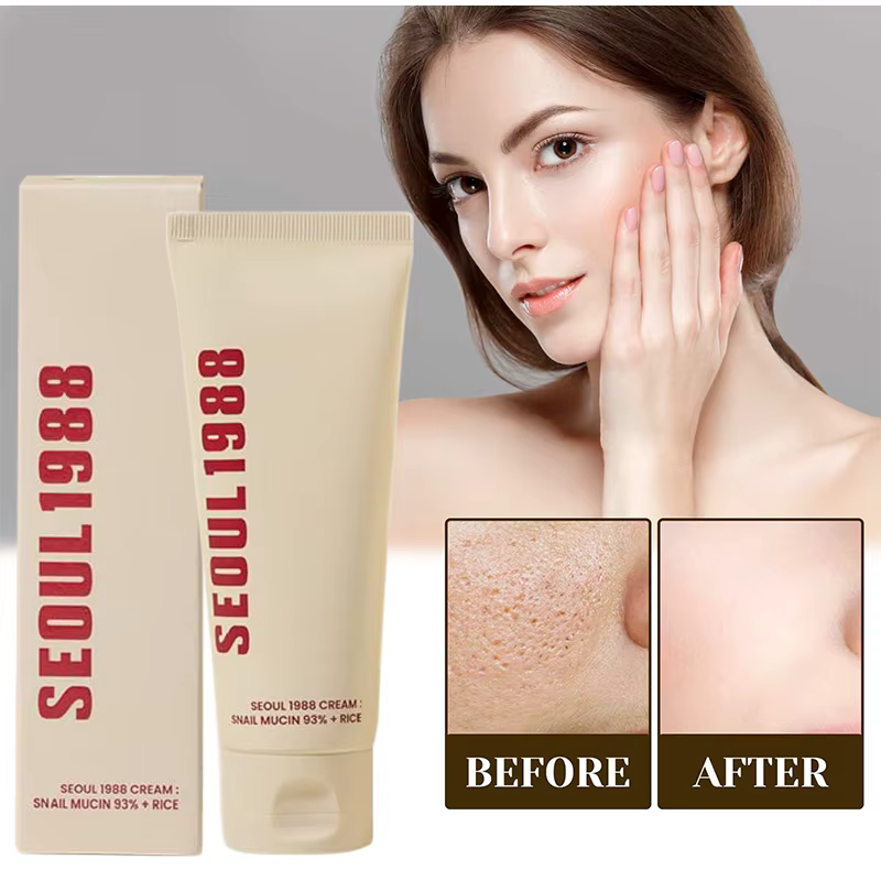Coréen séoul 1988 crème pour les yeux escargot Mucin ensemble de soins de la peau blanchir