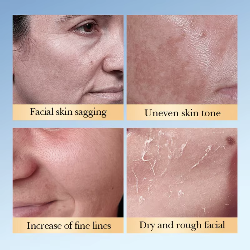 SADOER acide glycolique tonique visage sérum soin de la peau