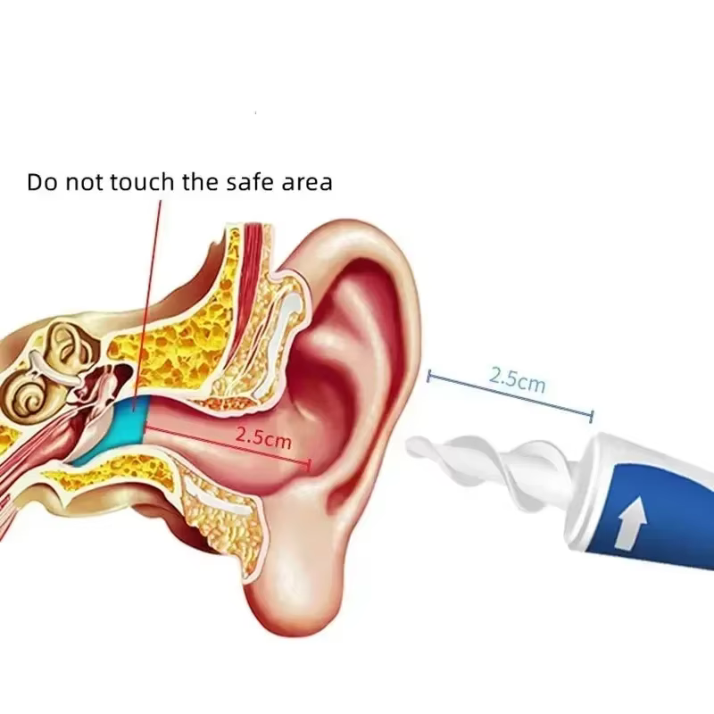 Nouvel outil de nettoyage d'oreilles en silicone en spirale, kit de nettoyage d'oreilles pratique et sûr, outil spécialisé pour le nettoyage rotatif des canaux auditifs à domicile