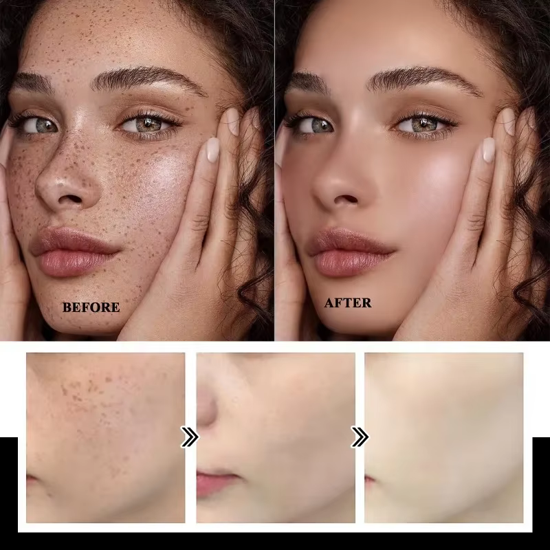 Crème éclaircissante au Melasma Niacinamide douce