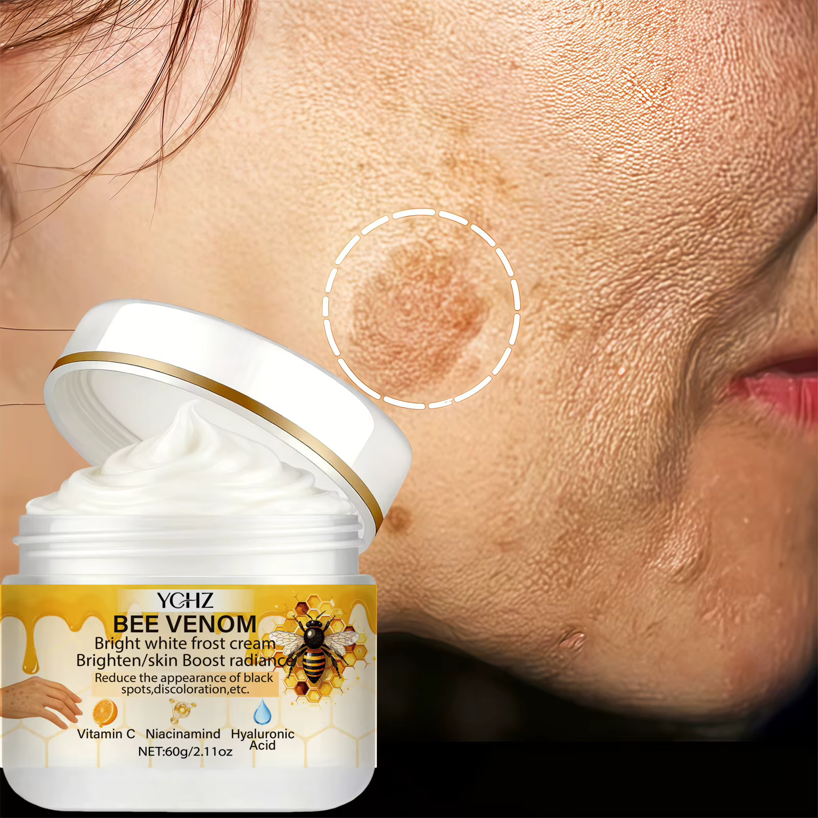 Crème éclaircissante au venin d'abeille