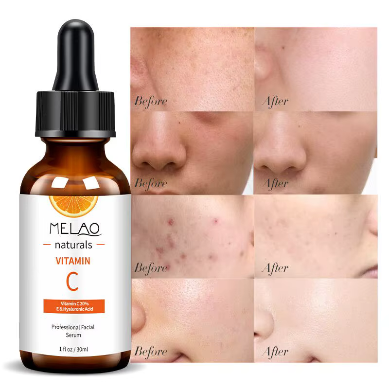 Tiroir AO-Sérum facial anti-âge à la vitamine C