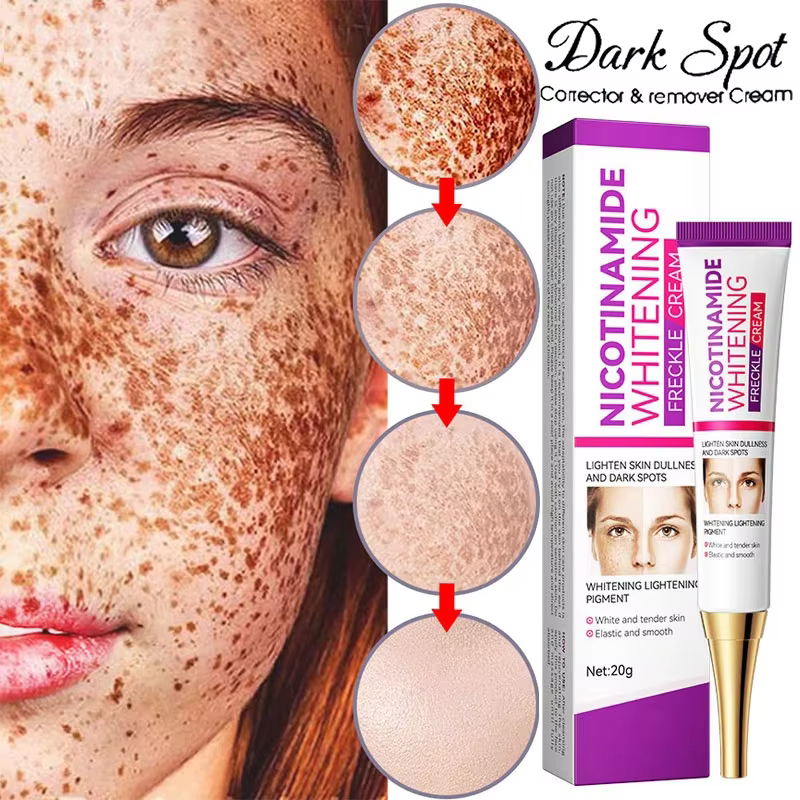 Crème éclaircissante au Melasma Niacinamide douce