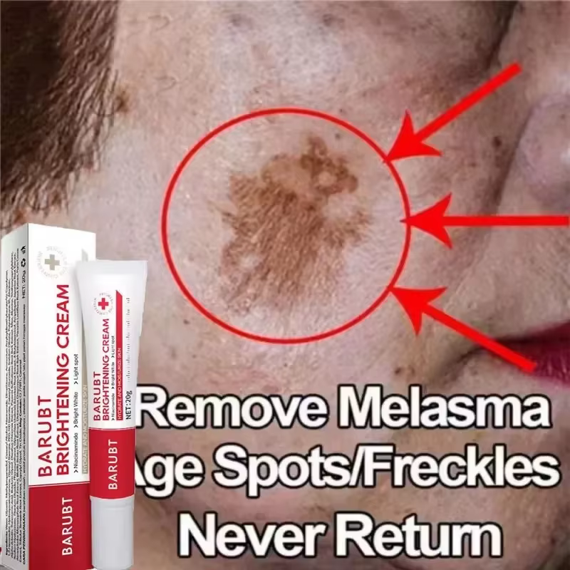 Crème blanchissante pour le visage