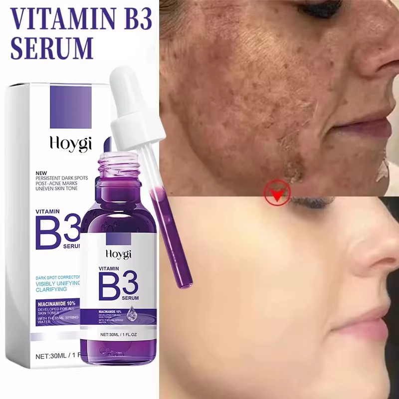 Sérum à la vitamine B3