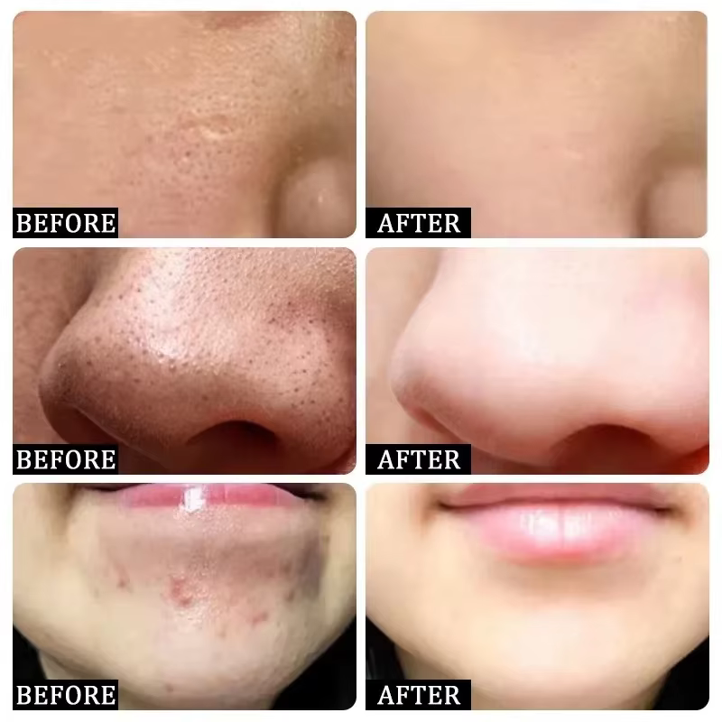 Sérum Coréen Resserre les Pores