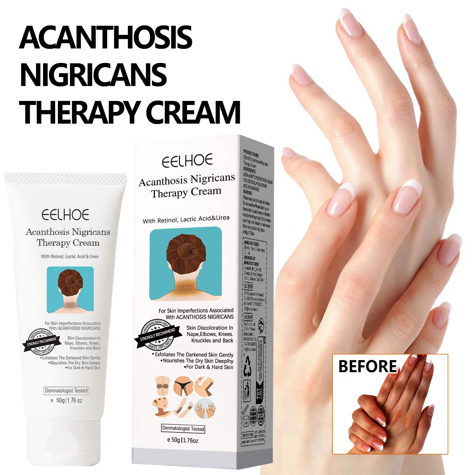 Crème blanchissante éclaircissante pour la peau foncée