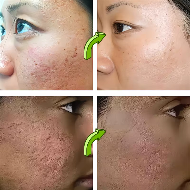 Sérum pour nettoyer les Pores du visage