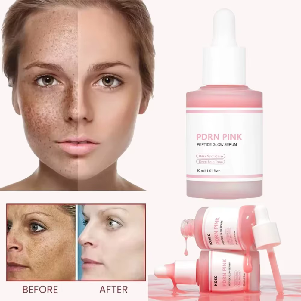 Sérum facial à la rose PDRN 30 ml avec peptide rose et adénosine