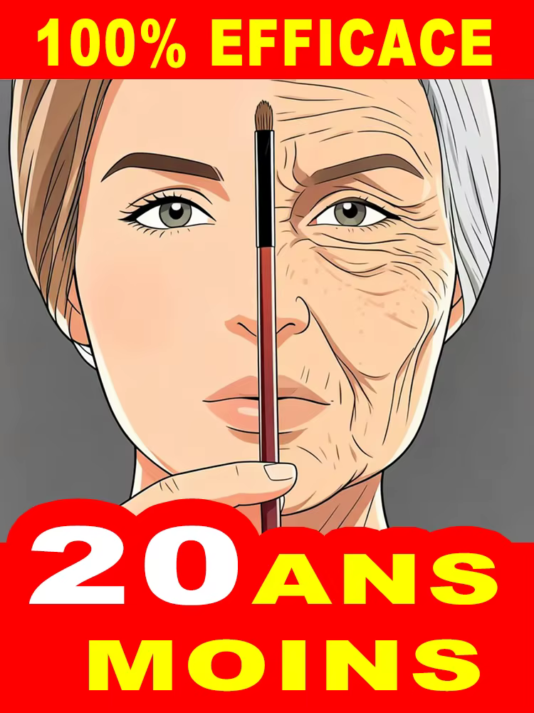 Pas de ridules, pas de rides