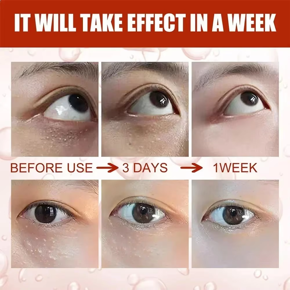 Crème pour les yeux dissolvant de granulés de graisse