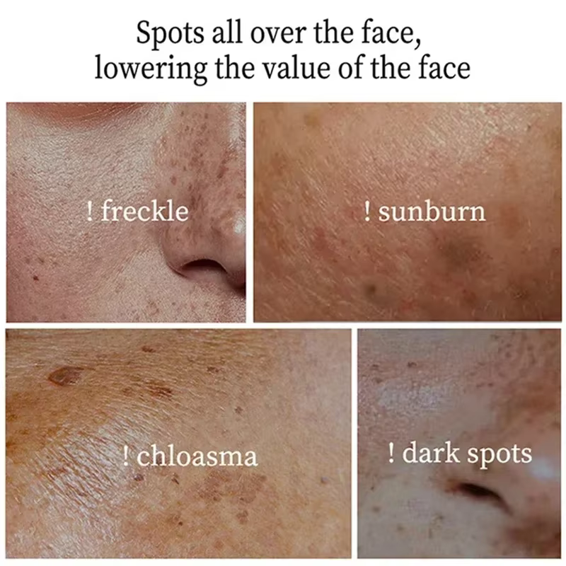 Crème blanchissante puissante anti-taches