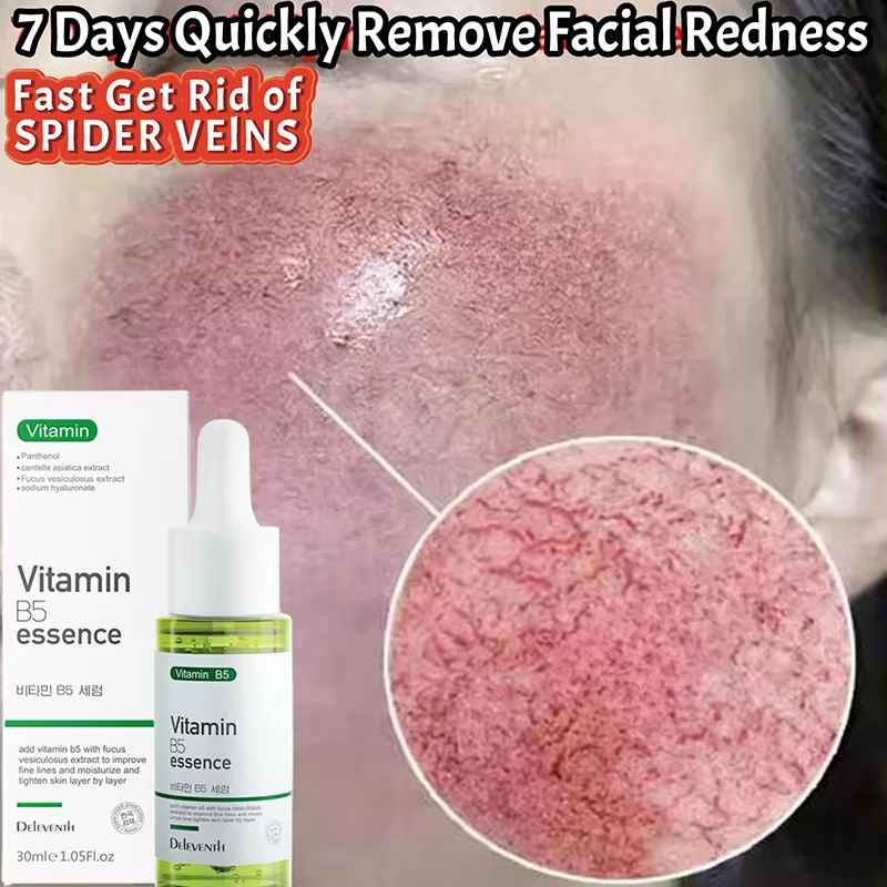 Sérum Réparateur Anti-Rougeurs Visage – Améliore la Peau Sensible et la Sécheresse – Hydratant Apaisant – Élimine la Rosacée – Cosmétiques Coréens