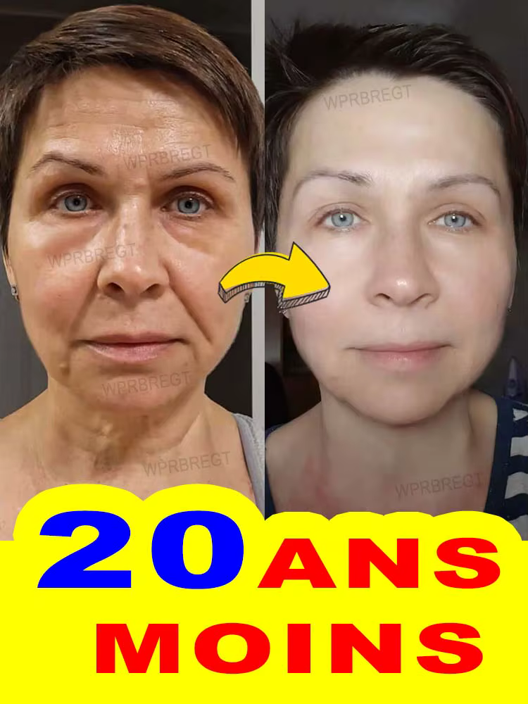 20 ans plus jeunes, pas de ridules