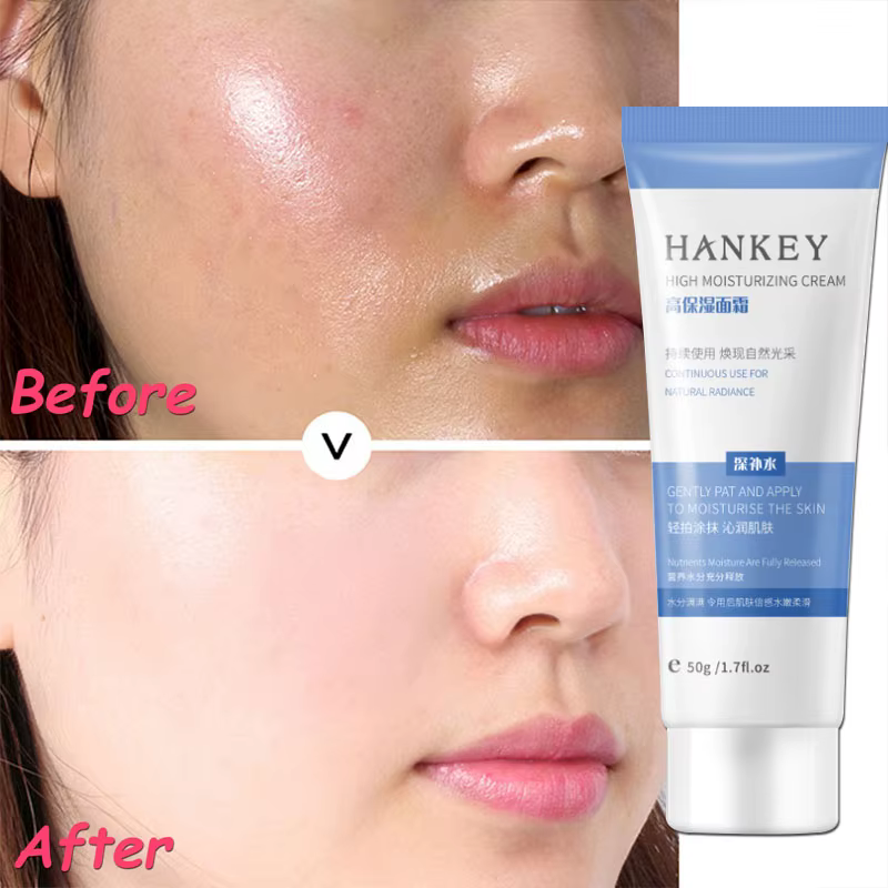 Crème Réparatrice Anti-Rougeurs Visage – Hydratant Apaisant pour Peaux Sensibles – Élimine la Rosacée et les Varicosités – Cosmétique Coréen