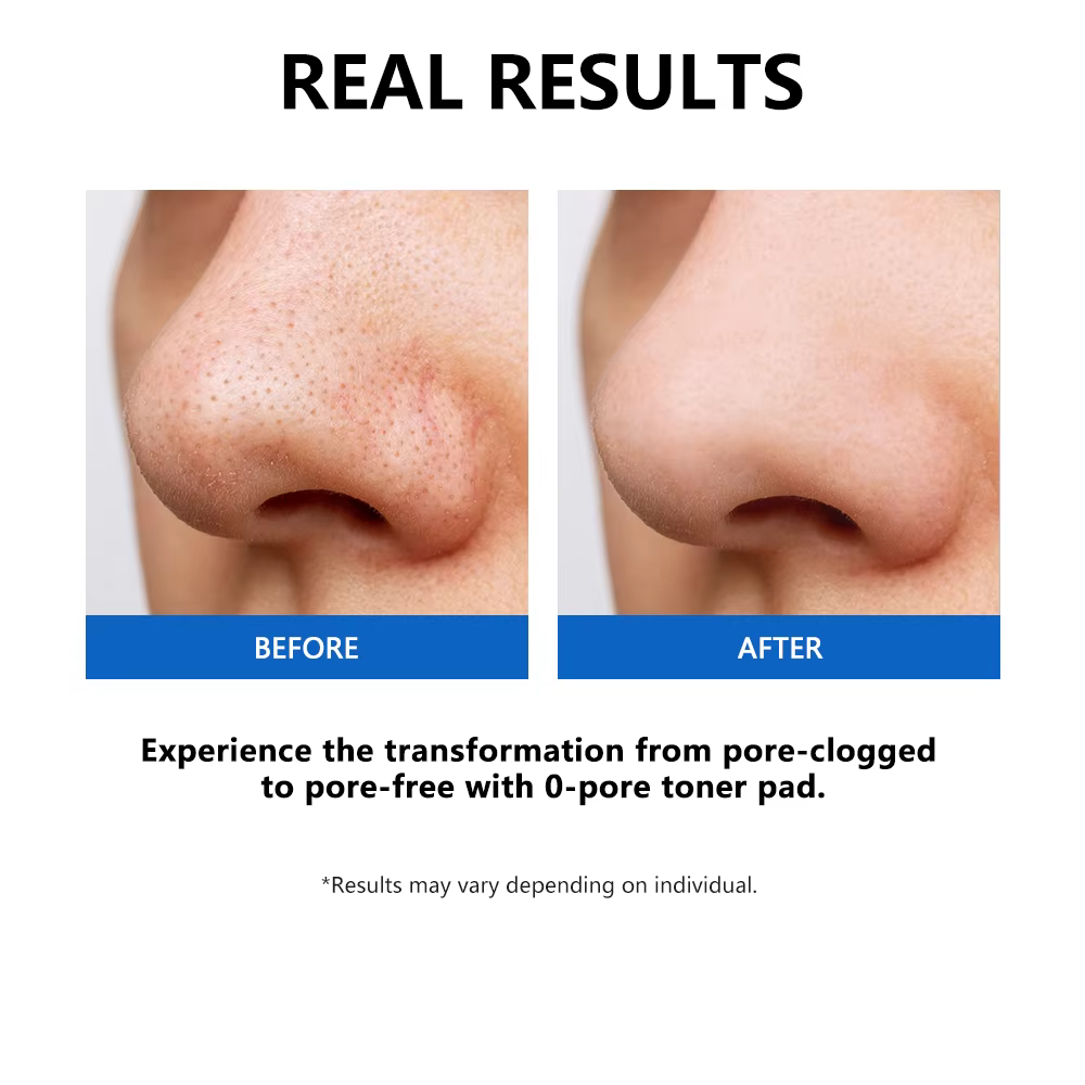 Coussinets de Toner pour pores zéro